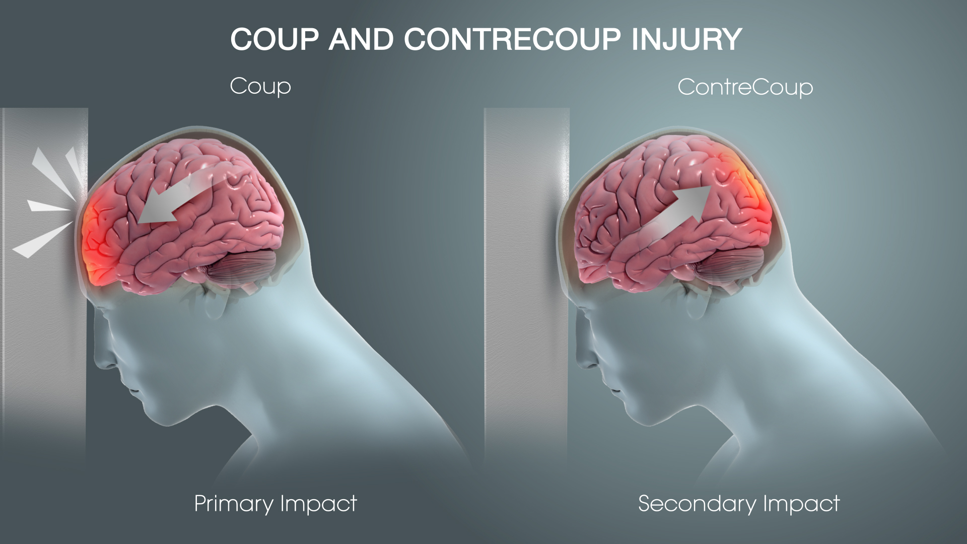 traumatic-brain-injury-tbi-definition-epidemiology