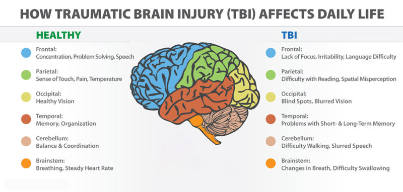 Traumatic Brain Injury (TBI) - Definition, Epidemiology ...