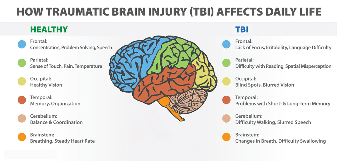 traumatic brain injury