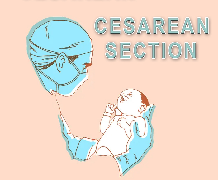 Instruments Names and their Uses in Cesarean Section Delivery